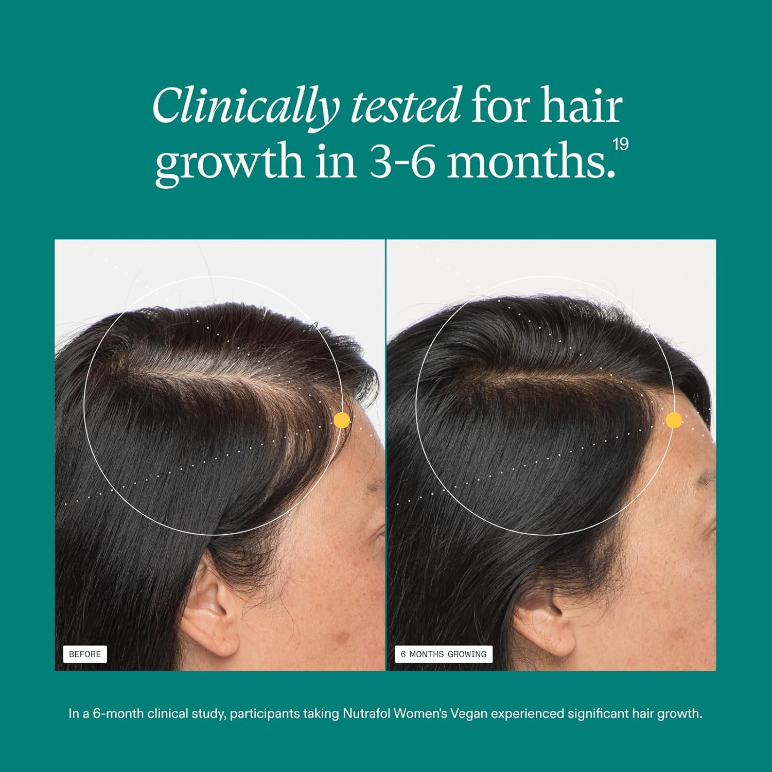 Nutrafol Women’s Vegan biotin-free hair growth nutraceutical supplement
