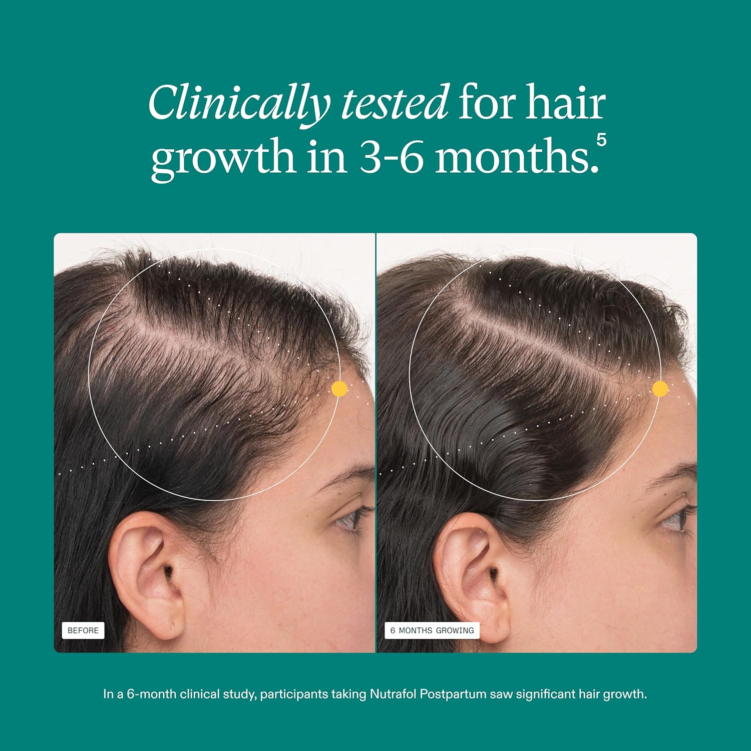 Nutrafol Postpartum OBGYN-formulated hair supplement with vitamins and botanicals