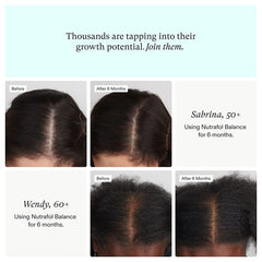"Healthy hair growth with Nutrafol Women’s Balance – natural supplement to combat thinning hair"